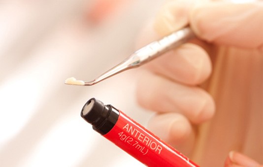 a dentist with composite resin on a dental tool