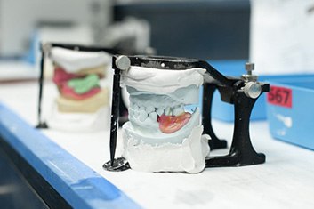 Dentures being crafted at lab