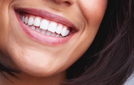 Closeup of patient's smile after professional teeth whitening