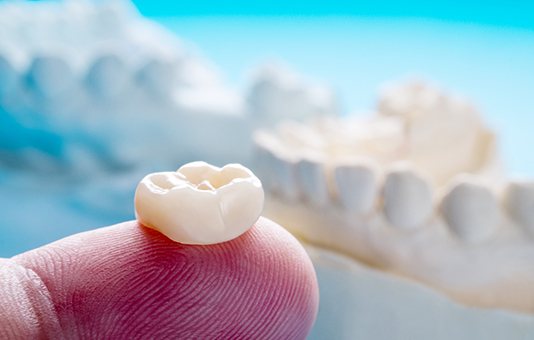 man smiling with dental crowns in Garland