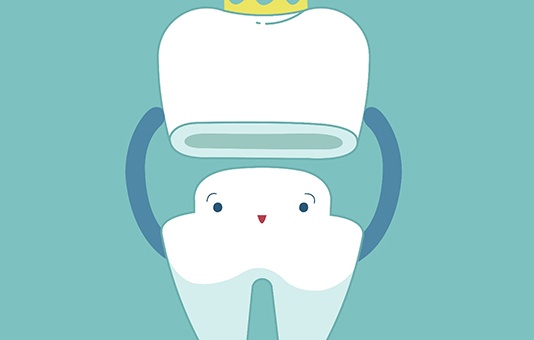 3D illustration Dental crowns in Garland  