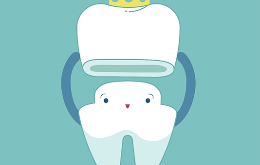 3D illustration Dental crowns in Garland