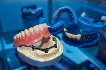 Example of implant dentures in Garland