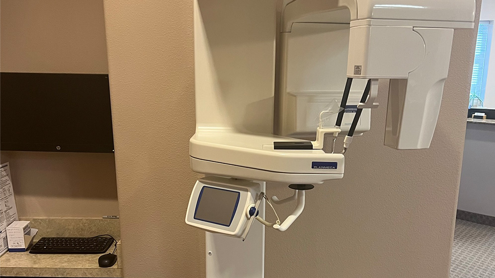 3 D C T cone beam digital x-ray scanner